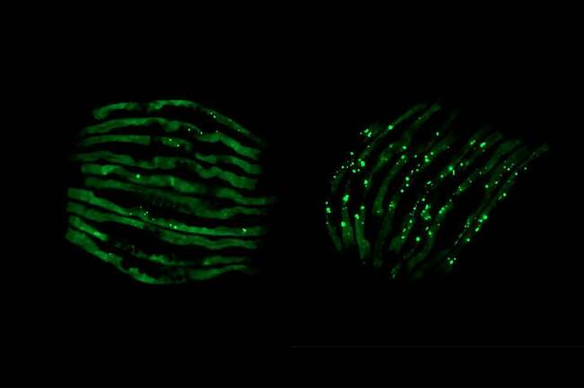 Scientists identify gut bacteria linked to neurodegenerative conditions : news