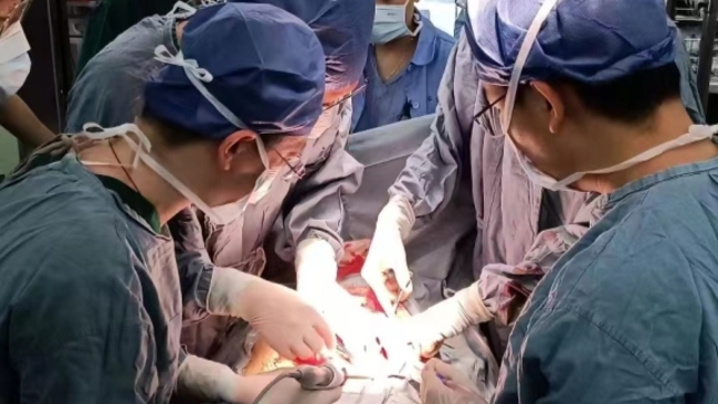 Shanghai doctors successfully remove a huge kidney tumor from a young woman