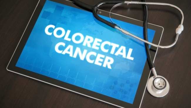 Colorectal cancer ranks second after lung cancer