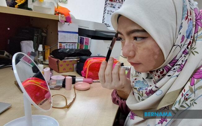 WOMAN WITH VITILIGO DETERMINED TO BREAK BEAUTY STEREOTYPES