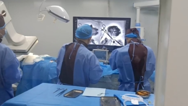 China completes world's first interventional BCI experiment on non-human primates