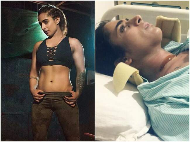 Exclusive - Roadies ex-winner Shweta Mehta on her near-fatal accident: Got 7 fractures in my neck; took 2 years to recover and went financially broke