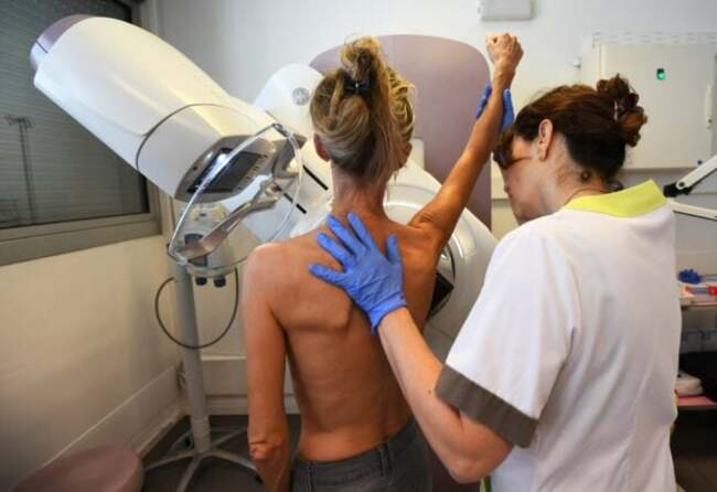 Mammograms should start at 40, says US task force