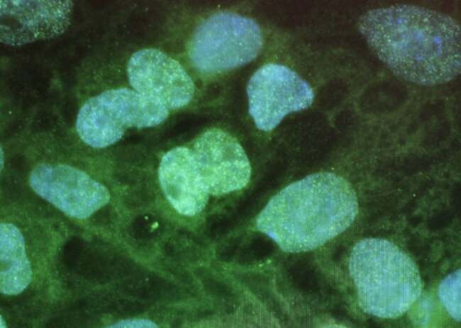 Lab-grown human embryo models spark calls for regulation