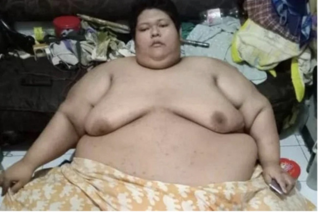 300kg Indonesian man who was forklifted onto a truck to be driven to hospital dies from illness