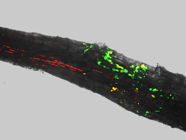 Underground Symbiosis Counters Drought
