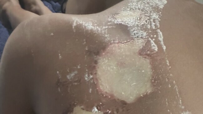 12-year-old who threw acid on girl in Detroit charged