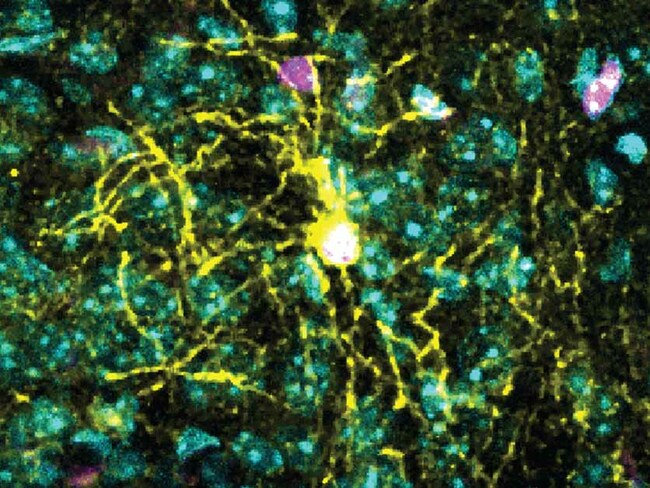 Male, Female Brain Cells Differ in Response to Chronic Stress