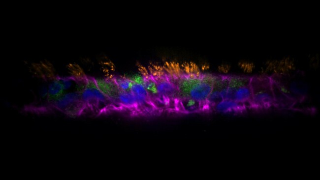 Organoids Transform Respiratory Infection Research