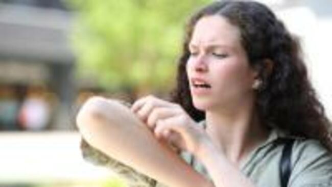 How to Stop Bug Bites from Itching