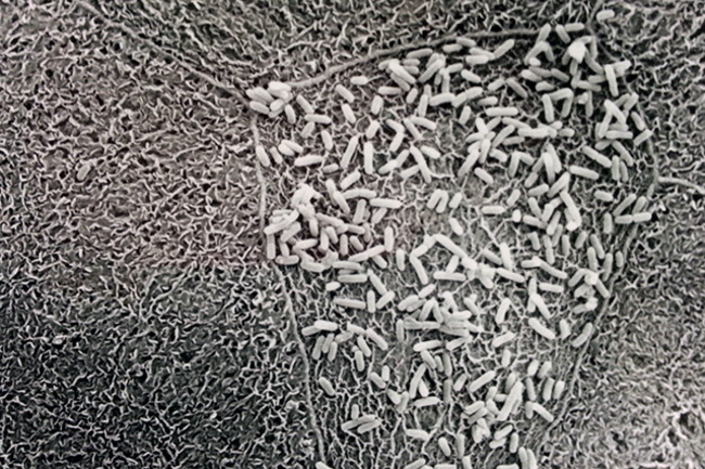 E. Coli Resistance Surges Despite Reduced Ciprofloxacin Use