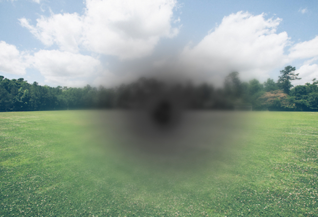 Eye Center Trials Gene Therapy for Wet Macular Degeneration