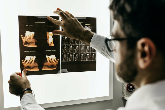 Early Intervention Shields Brain Metabolism from Cardio Risks