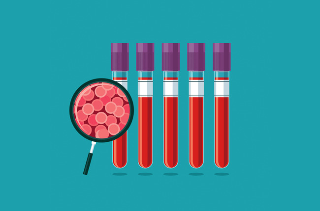 Oakland Hospital Leads West in Pioneering Beta Thalassemia Drug