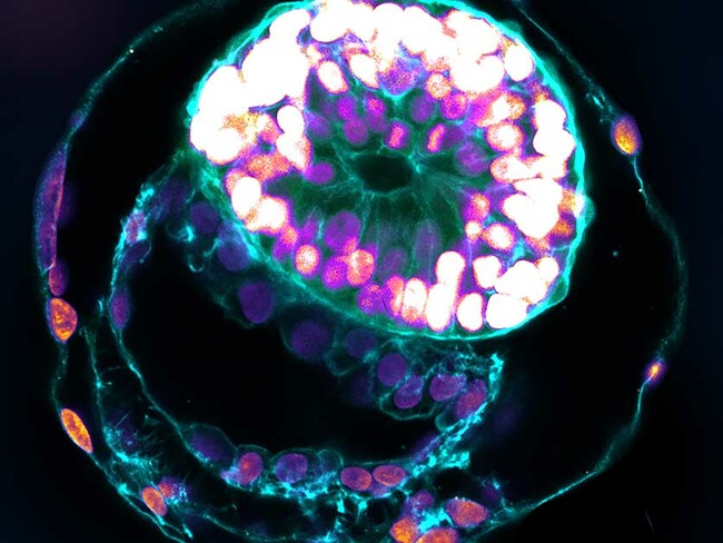 Human Embryo Models Grown from Stem Cells