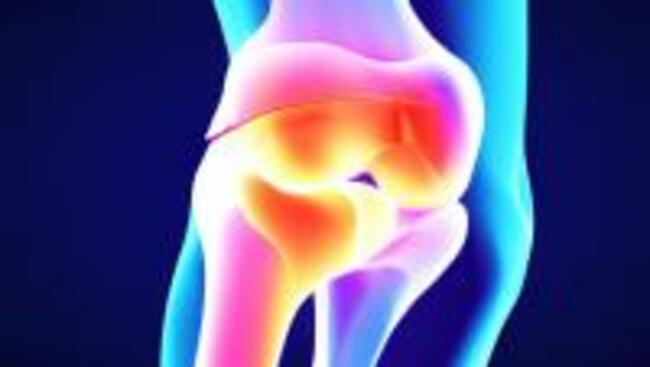 Promising New Drug Battles Osteoarthritis Cartilage Loss