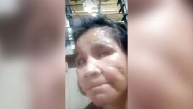 Gunman attacks witness in alleged abused maid's case, PNP launches manhunt