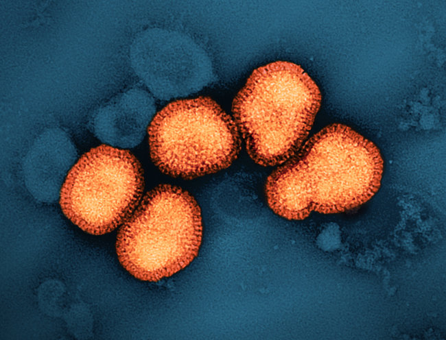 Universal Flu Vaccine Candidate Enters NIH Clinical Trial