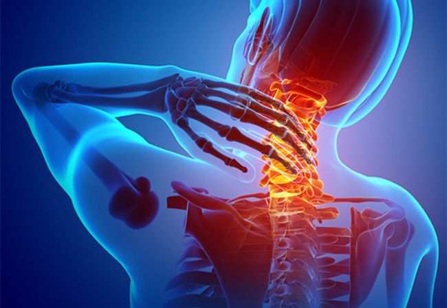 Initial Provider Impacts Neck Pain Tests, Imaging & Care