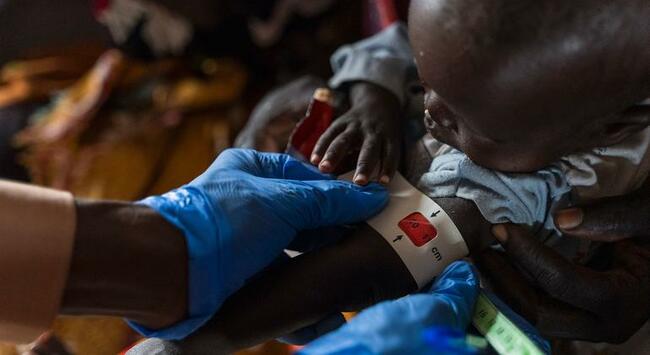 Sudan's Healthcare System Collapse Causes Child Deaths