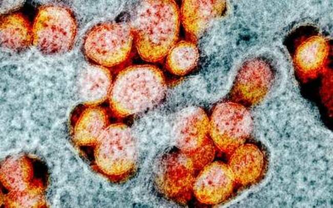 Covid May Unlock Detection of Pandemic-Prone Viruses