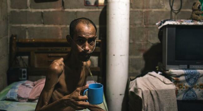 UN Commits to Eradicating Tuberculosis Globally by 2030