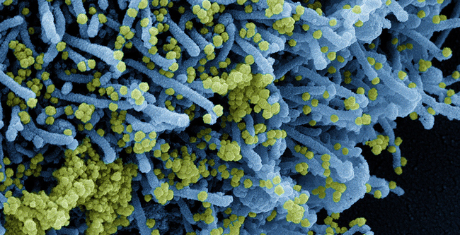 EHRs Uncover Early COVID Pandemic's Immune Overreaction Burden