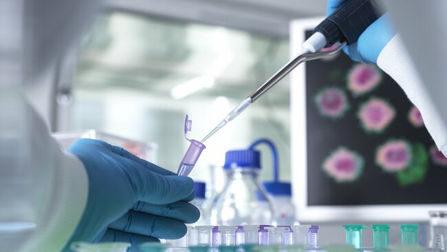 Covid-19 cases are decreasing but 'remain high' - HPSC
