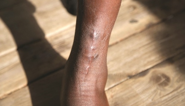 Transit, terror and torture: Rescued migrants recount Libya horrors