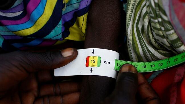Malnutrition in Sudan's El-Fasher kills 63 in a week: health official