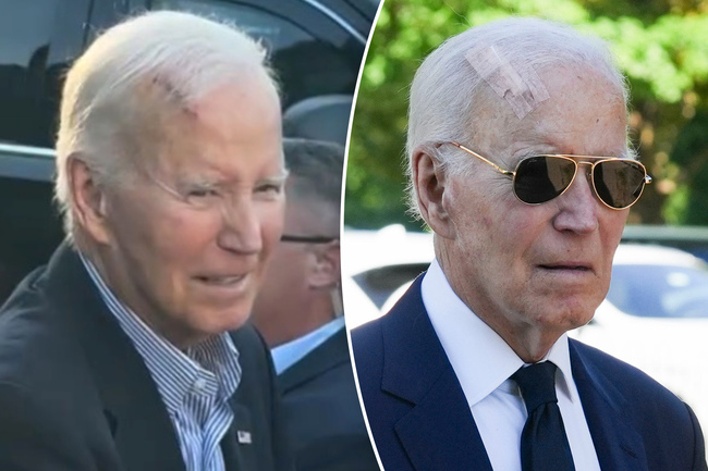 What is Mohs surgery? All about the procedure to remove President Joe Biden’s new cancer