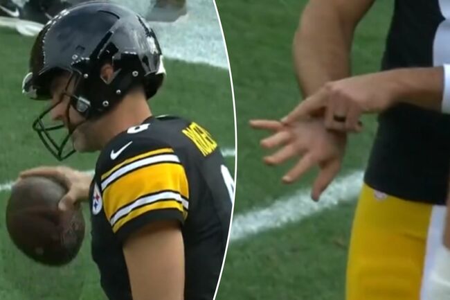 Aaron Rodgers suffers apparent hand injury in warmups before Steelers game