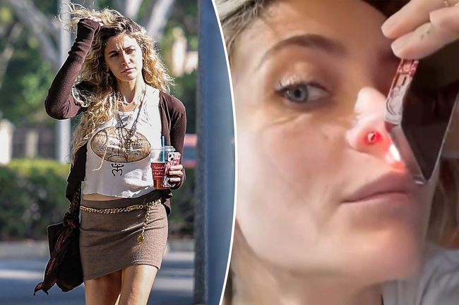 Paris Jackson defends sharing graphic photo of her perforated septum from years of drug abuse