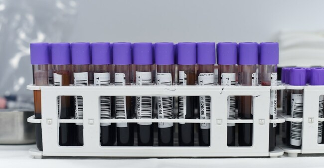 Why you should donate blood, briefly explained