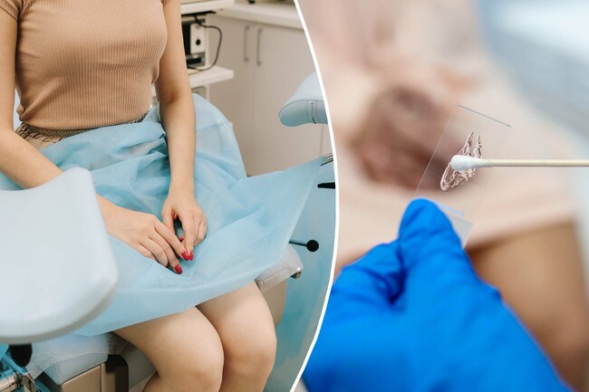 Hate your Pap smear? An at-home screening could replace it for women over 30, say new US guidelines