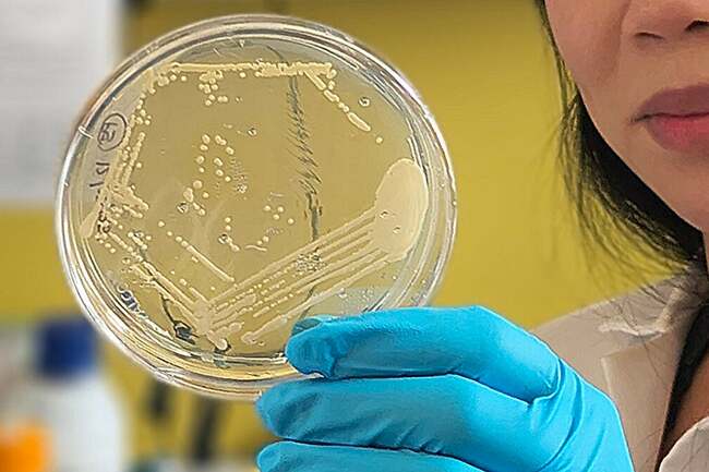 Study helps explain rare condition that causes the body to produce its own alcohol