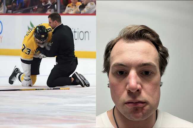 "Florida gotta be paying the league": Fans react as Charlie McAvoy shares selfie of swollen face after controversial hit from Sandis Vilmanis