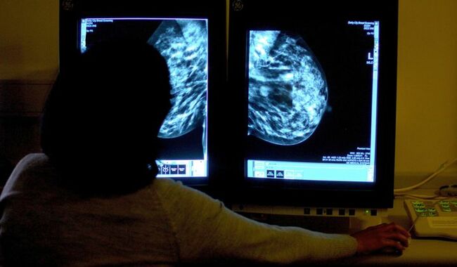 Breast cancer rates are highest in wealthy countries such as Ireland, study finds