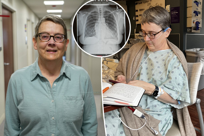 NASA engineer undergoes groundbreaking double-lung transplant — now she’s cancer-free