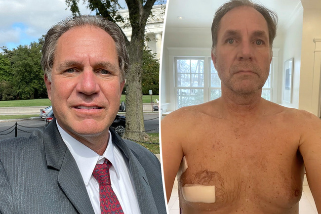Nipple-twisting prank between friends may have saved man’s life