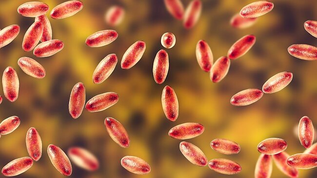 Russian researcher feared to have died of plague after lab accident