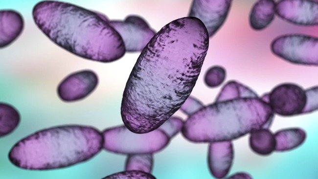 Russia plague: What we know about the suspected case reportedly linked to a lab worker’s death