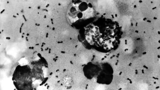 Employee of Russian plague institute dies of suspected pneumonic infection