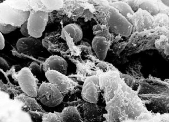 What to know about plague after suspected Siberian lab worker case 