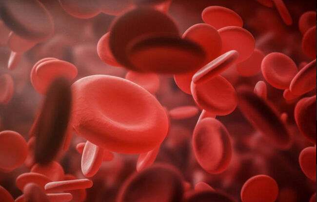 Low and high hemoglobin levels closely associated with cognitive decline in elderly