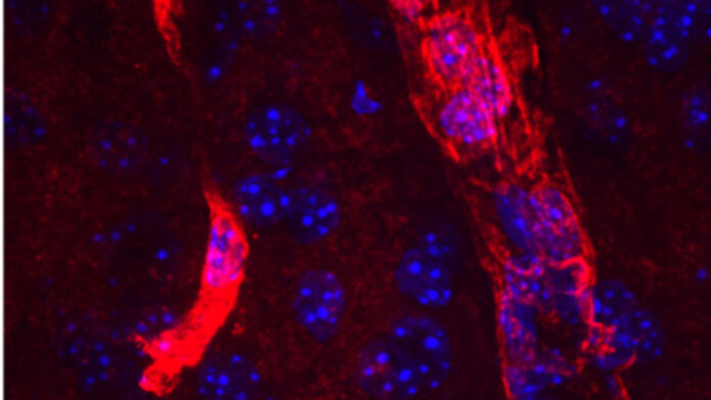 Researchers tap into nature's way of clearing waste to treat Alzheimer's disease