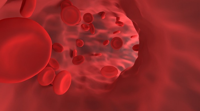 Voltaglue device developed to seal blood vessels
