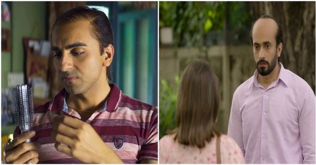 Man In His 30s Asks If Receding Hairline & Balding Is A Deal-Breaker, Women Respond