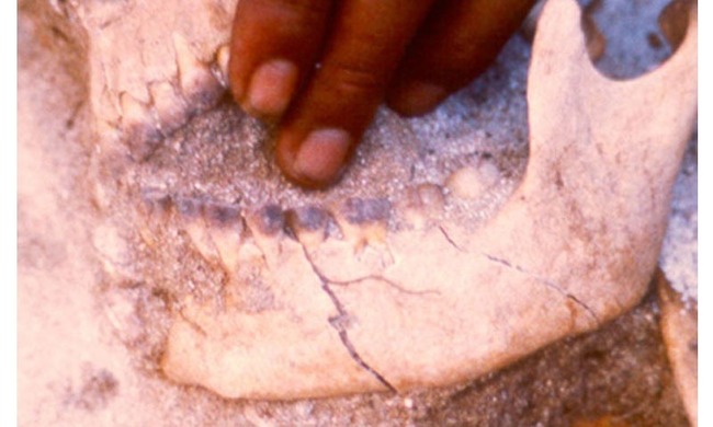 Digging into Guam's history: Ancient Chamorro body modification
